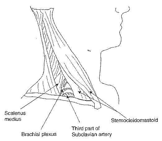Nerve and blood vessel compression in the neck
