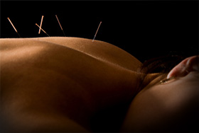 acupuncture in brisbane