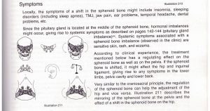 Sphenoid Bone Symptoms