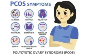 PCOS Symptoms